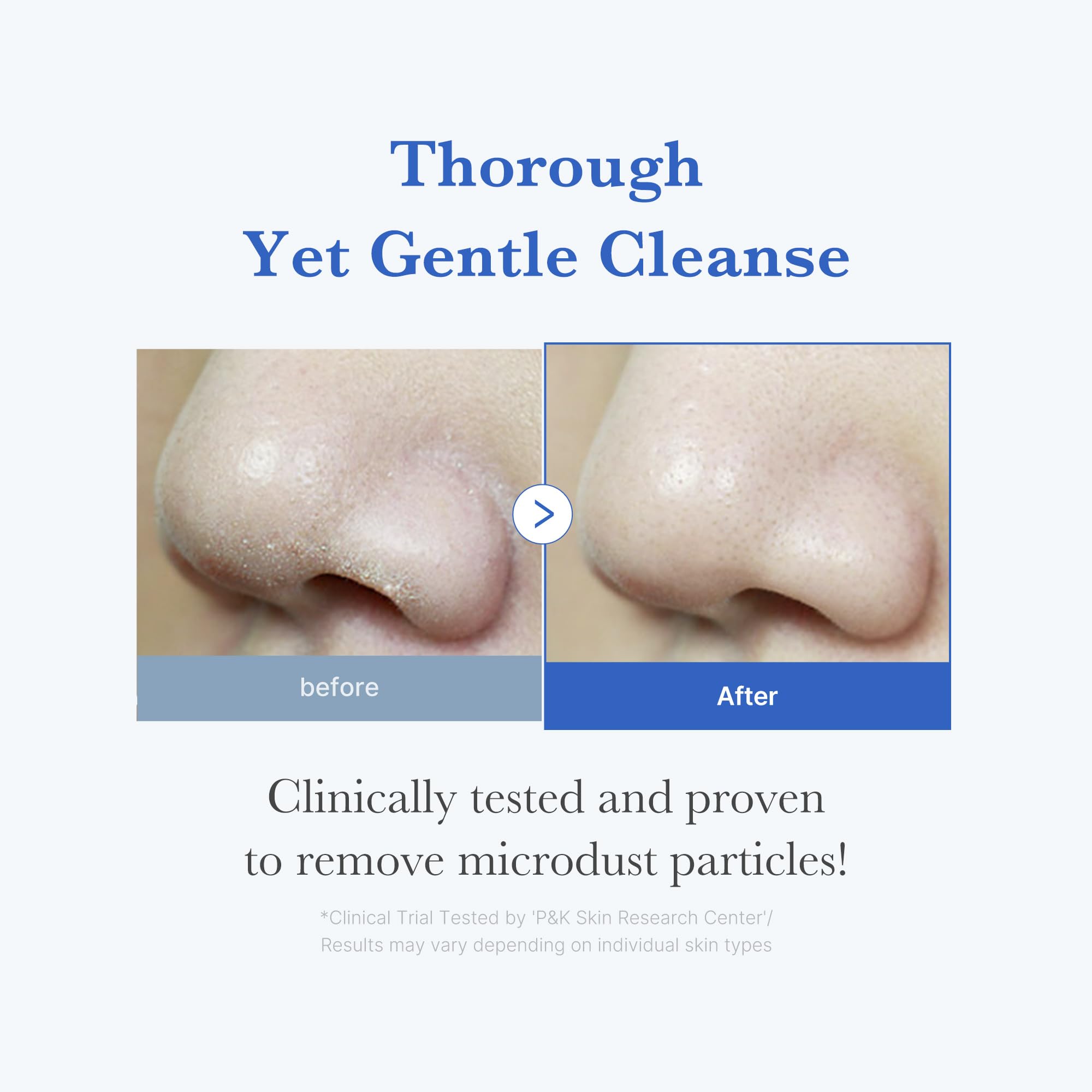 medicube Azelaic Acid Gummy Whip Cleanser | Cleansing Foam For Troubled Skin | Use After Spot Care & Excess Sebum Control | Niacinamide, Glycerin | Soothing, Pore Cleansing Face Wash | Korean Skincare