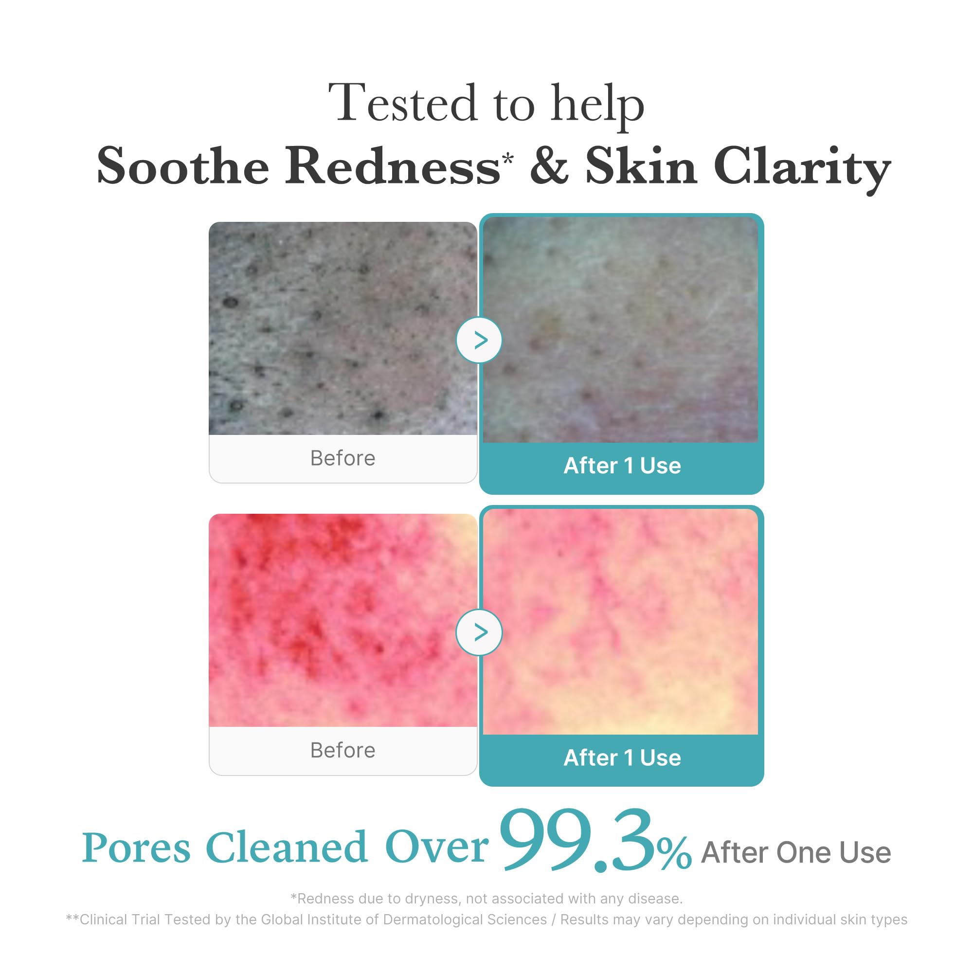 medicube Azelaic Acid Gummy Whip Cleanser | Cleansing Foam For Troubled Skin | Use After Spot Care & Excess Sebum Control | Niacinamide, Glycerin | Soothing, Pore Cleansing Face Wash | Korean Skincare