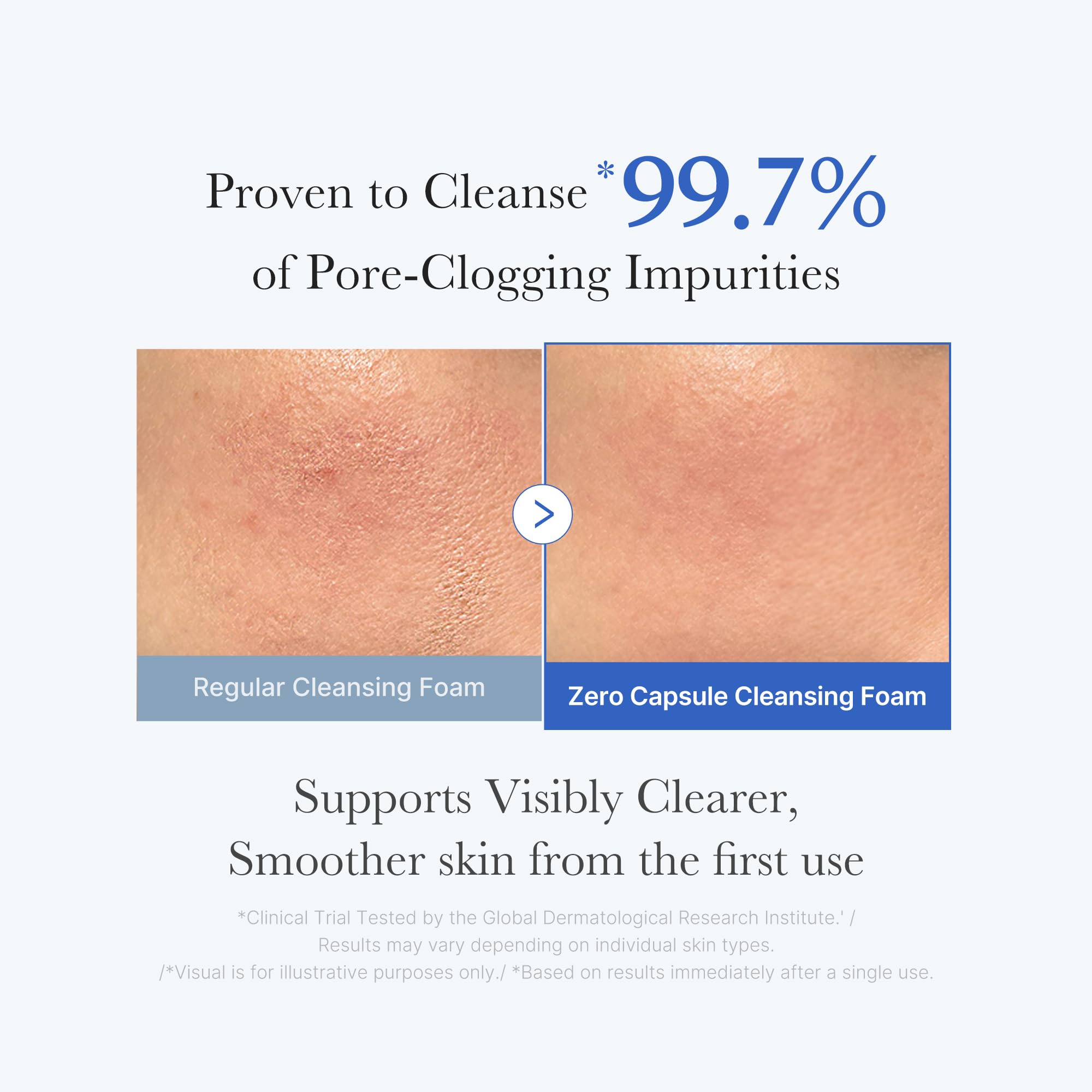 medicube Azelaic Acid Gummy Whip Cleanser | Cleansing Foam For Troubled Skin | Use After Spot Care & Excess Sebum Control | Niacinamide, Glycerin | Soothing, Pore Cleansing Face Wash | Korean Skincare
